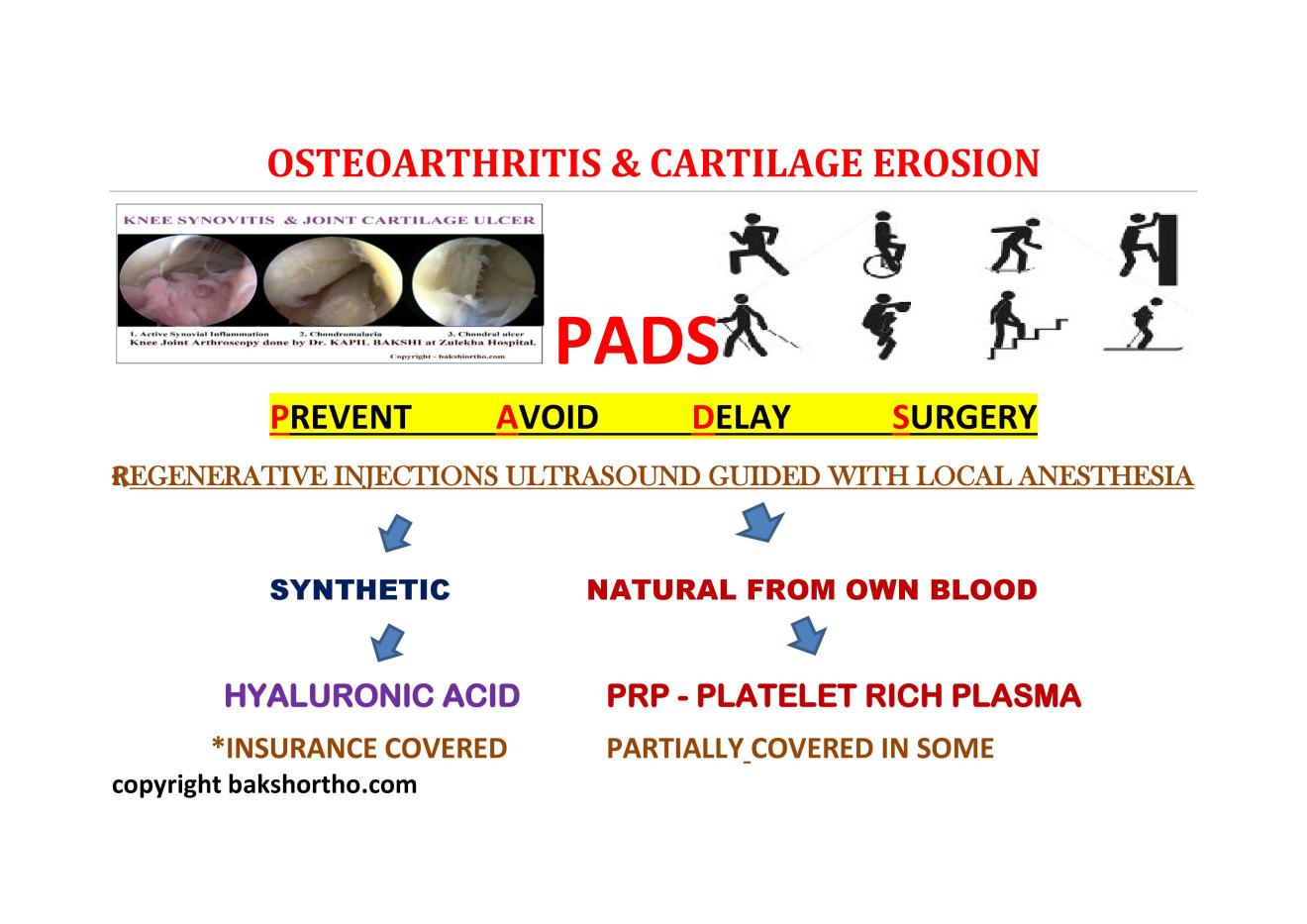 Osteoarthritis and Cartilage Erosion – Dr. Kapil Bakshi (Bakshi ...