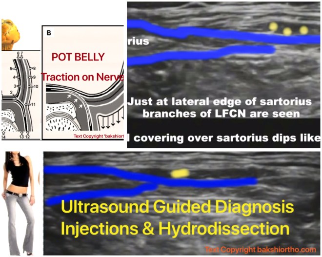 D1E51BEF-AA81-4CAC-B3CF-B4D560E6DECA