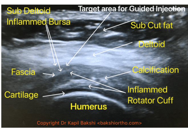 75AA8722-8670-42DA-BFA7-8CB2A0BC5CDE