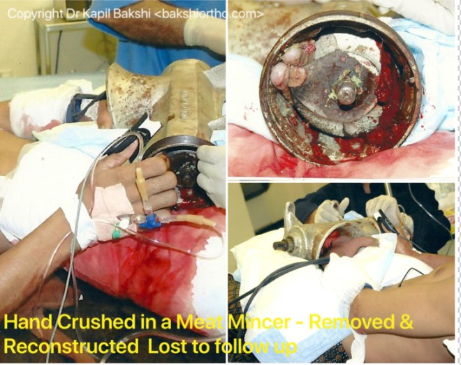 1D90FCA9-6FF3-420A-9698-97524D74E484