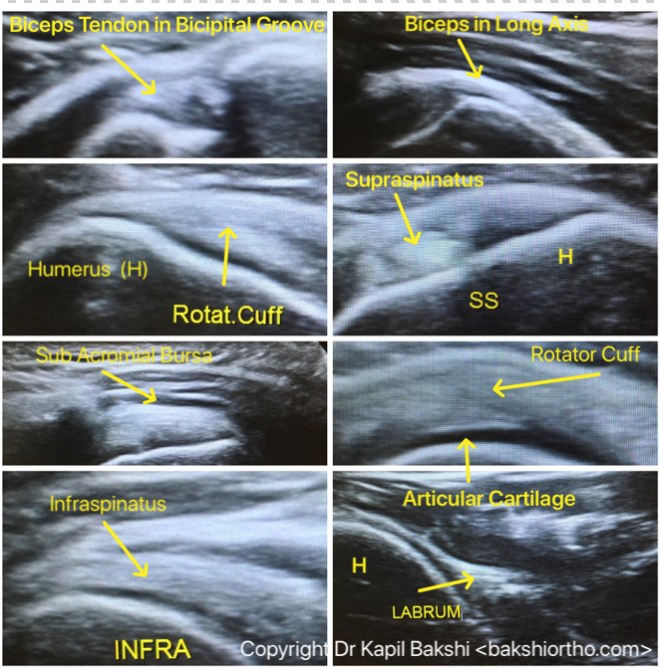 4FEABE87-1983-452B-B69D-88C7404E9A5F