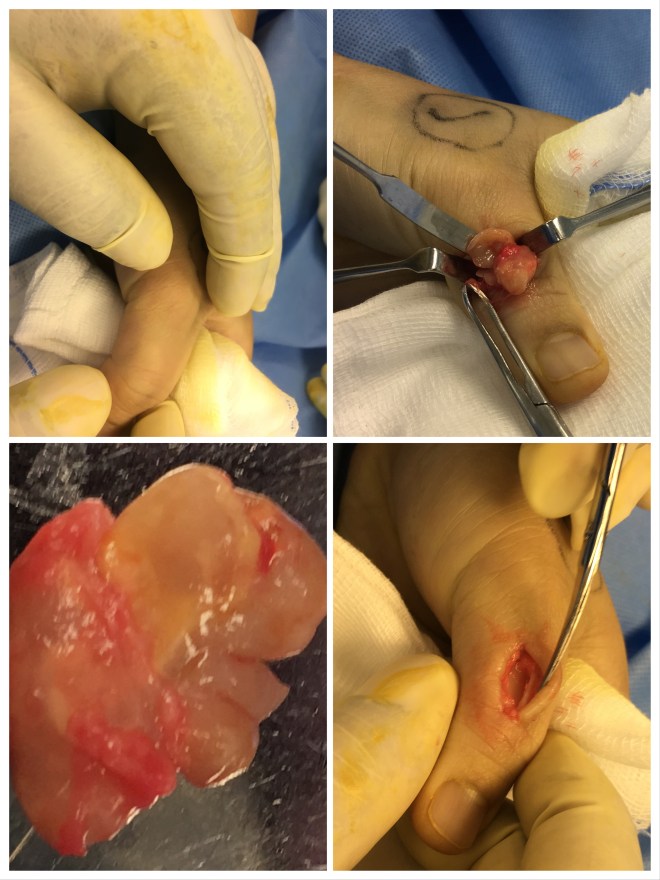 CA585B4C-ACAC-4EEB-8EA9-004468DB5EA4