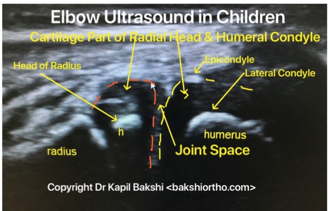 BD367E5D-855E-4186-AE0D-840378024B0B