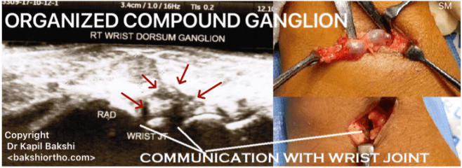 47BDDACC-FECF-4C8E-BDA5-6DE1B7C0111E