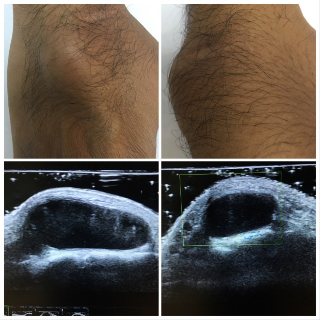 B60B7DEE-9E51-4108-B988-5B104B638F7F