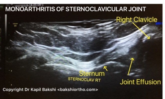 C437231F-EA62-446E-9421-5346EEBFCEC4